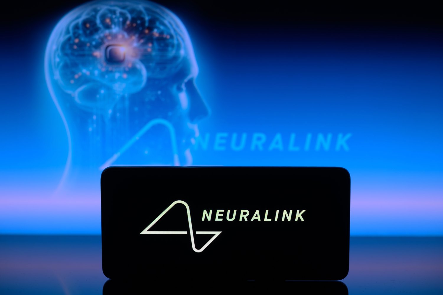 Neuralink mène un nouvel essai clinique. ©JRdes / Shutterstock