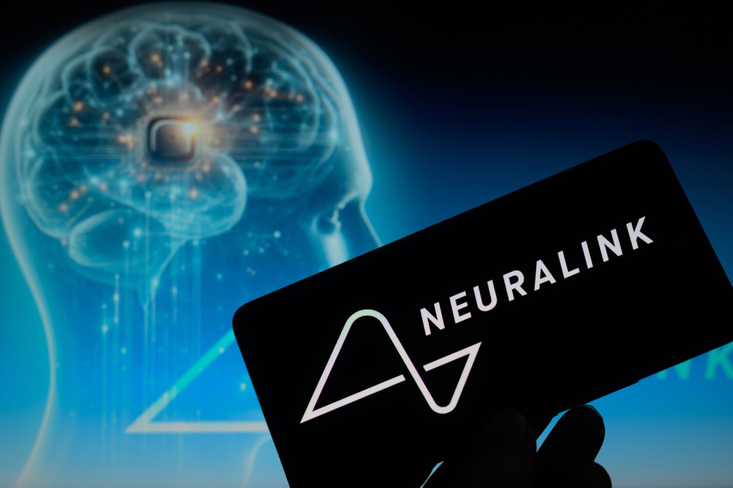 Neuralink progresse discrètement. ©JRdes / Shutterstock.com
