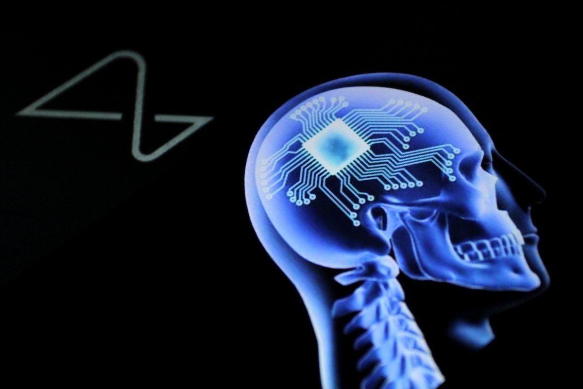 Neuralink veut permettre aux personnes paralysées de contrôler des dispositifs électroniques par la pensée © Kemarrravv13 / Shutterstock