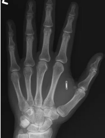 Une main connectée © Zi Teng Wang sur Facebook