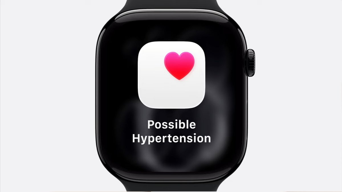 Un suivi de l'hypertension intégré à l'Apple Watch Series 11 ©Apple