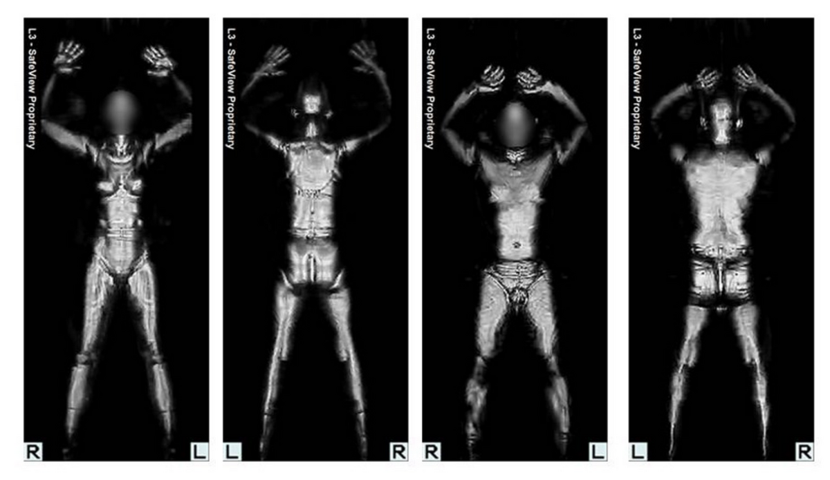 Image provenant d'un scanner corporel à ondes millimétriques