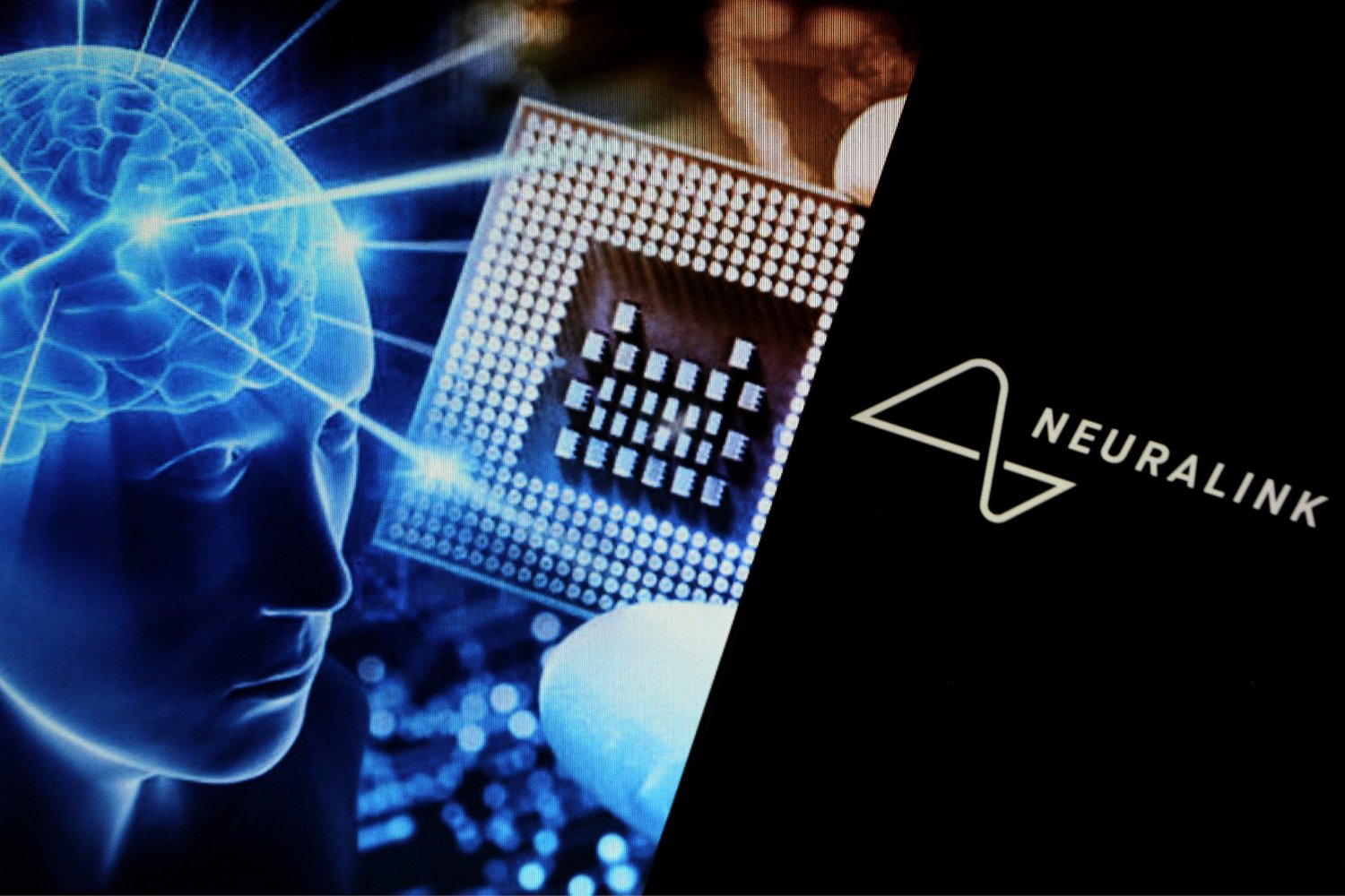 Neuralink développe des implants cérébraux. ©Kemarrravv13 / Shutterstock