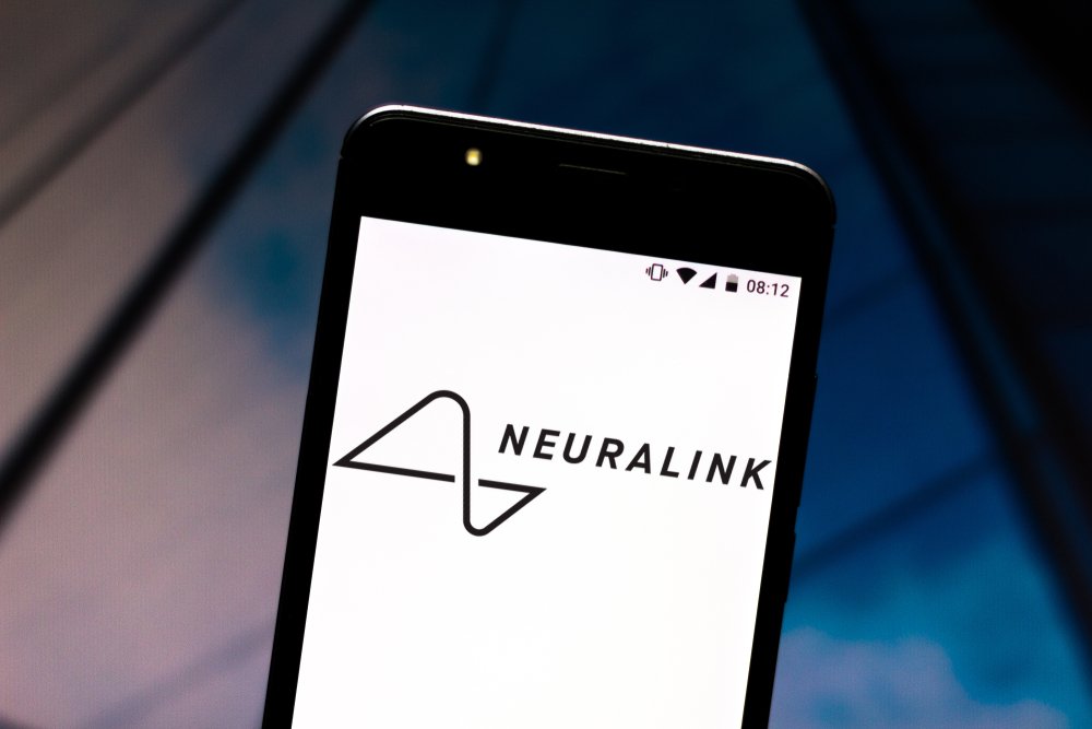 Neuralink veut tester son implant sur davantage de patients. © Shutterstock