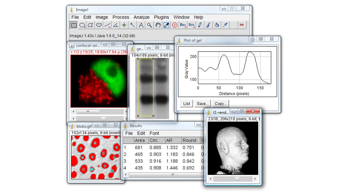 ImageJ est un logiciel open source d’analyse et de traitement d’images en Java, compatible avec tous les systèmes, modulable par plugins et largement utilisé en recherche scientifique et technique - © ImageJ