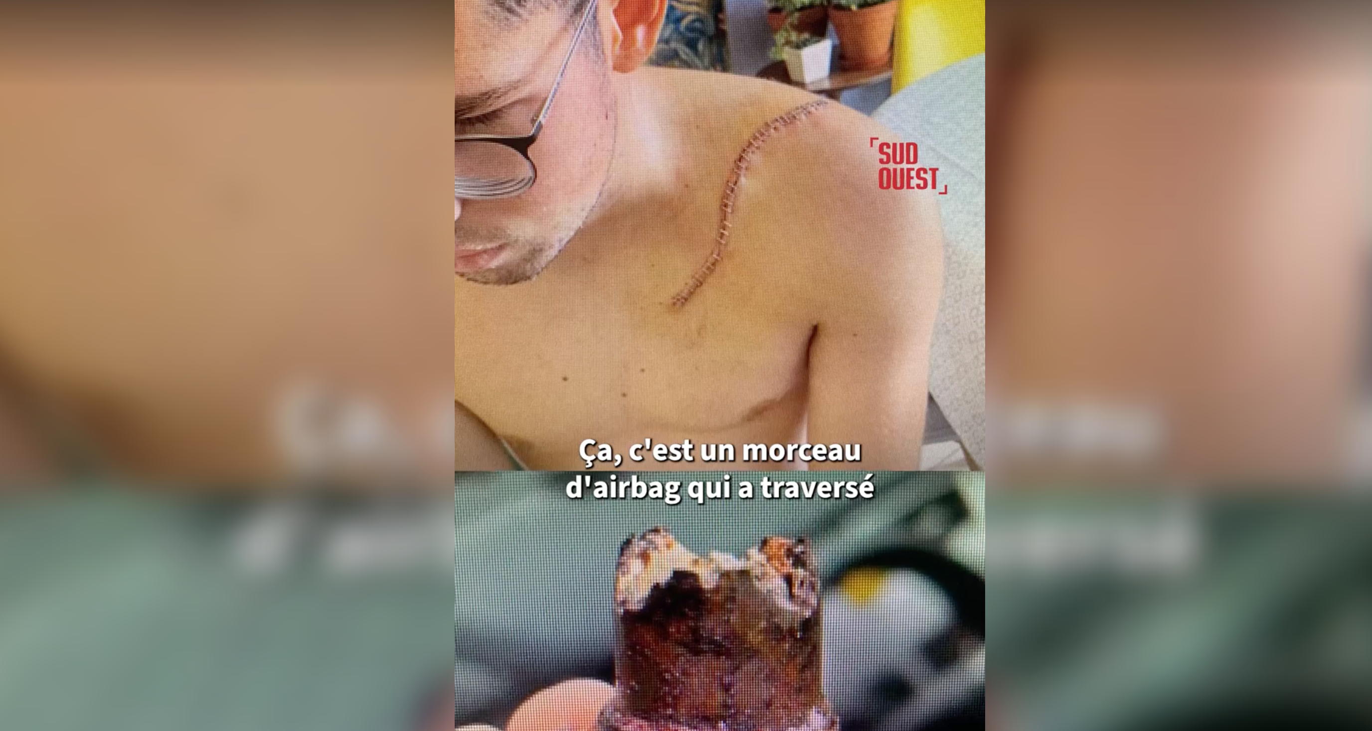 Les dégâts causés peuvent être importants, voire mortels - © Capture d'écran vidéo SudOuest