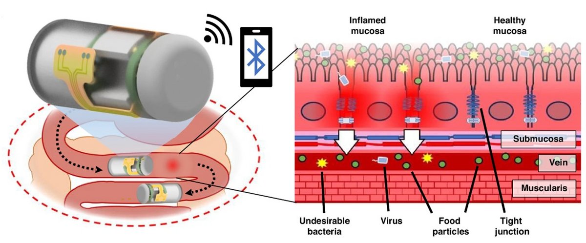 Schéma général illustrant la capsule ingérable surveillant la bioimpédance dans l'intestin grêle - © nature.com