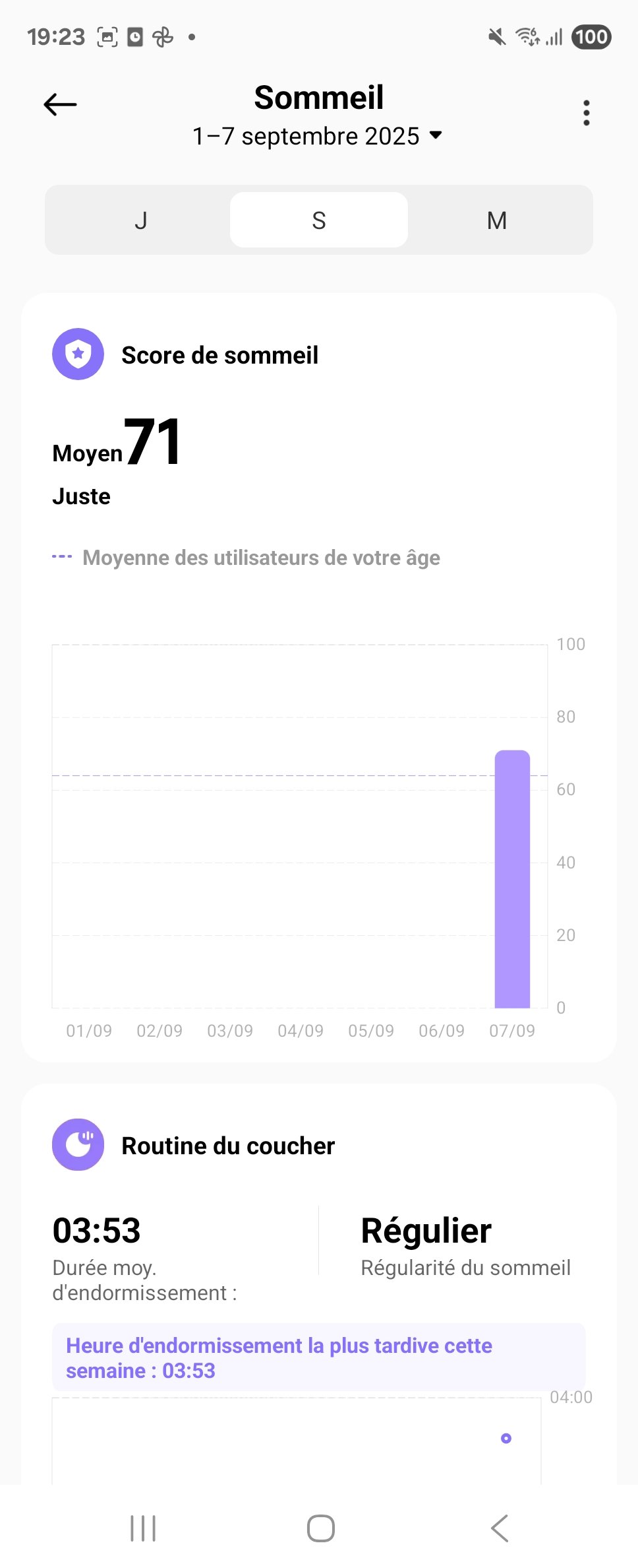 Xiaomi Watch S4 sommeil