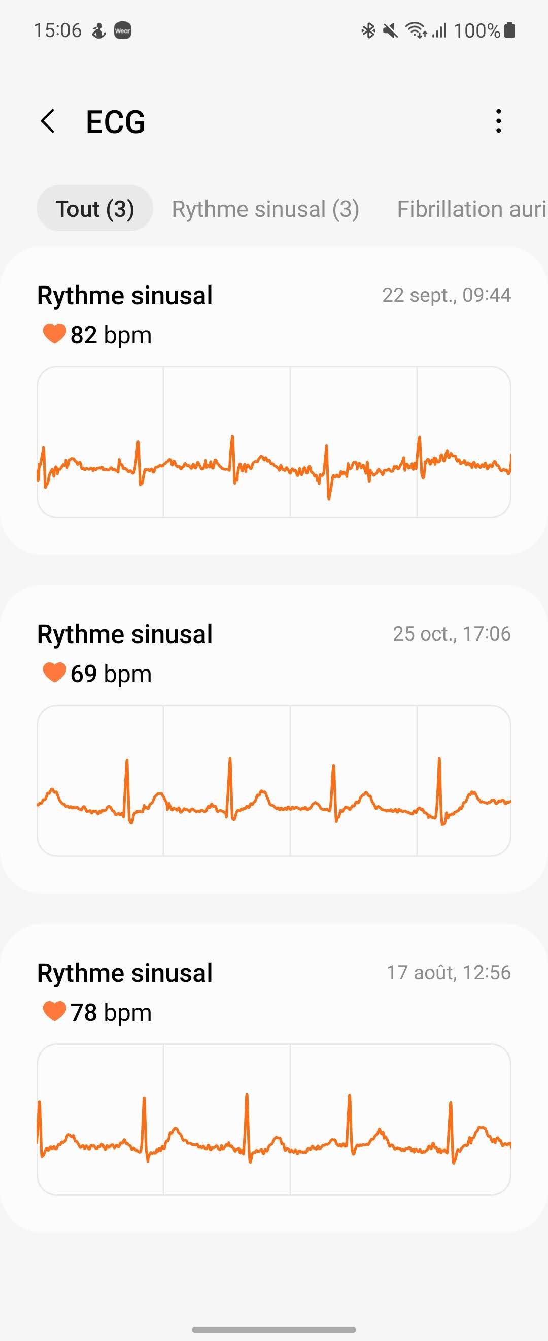 Samsung Monitor - ECG