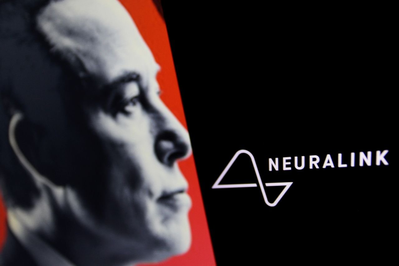 Neuralink d’Elon Musk veut permettre à des personnes paralysées de commander des prothèses, à certains patients de retrouver la parole et rendre la vue aux malvoyants - ©Kemarrravv13 / Shutterstock
