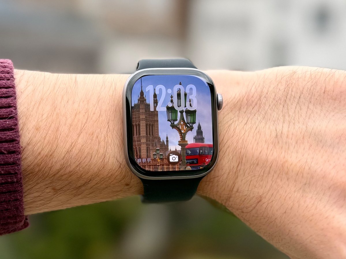 Apple Watch Series 11 Photos