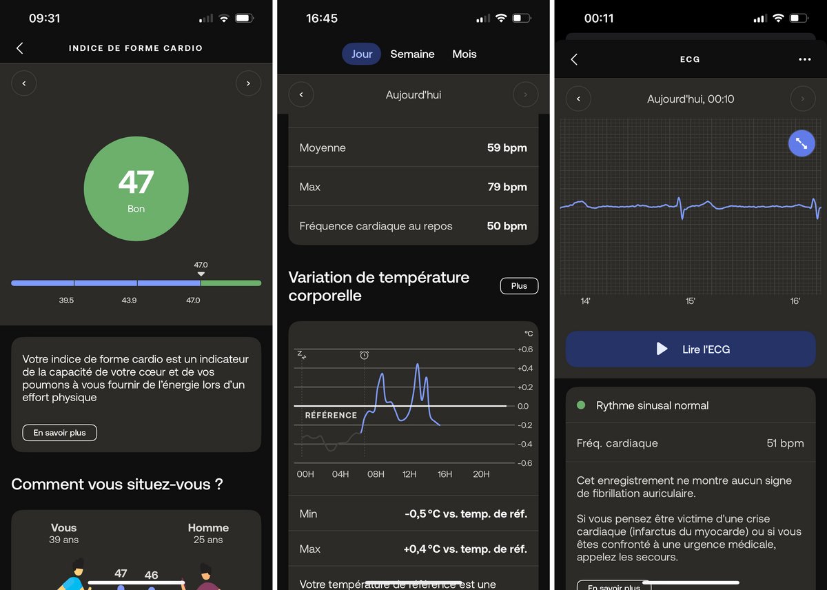 Indice de forme cardio, variation de température corporelle et ECG sur l'app Withings