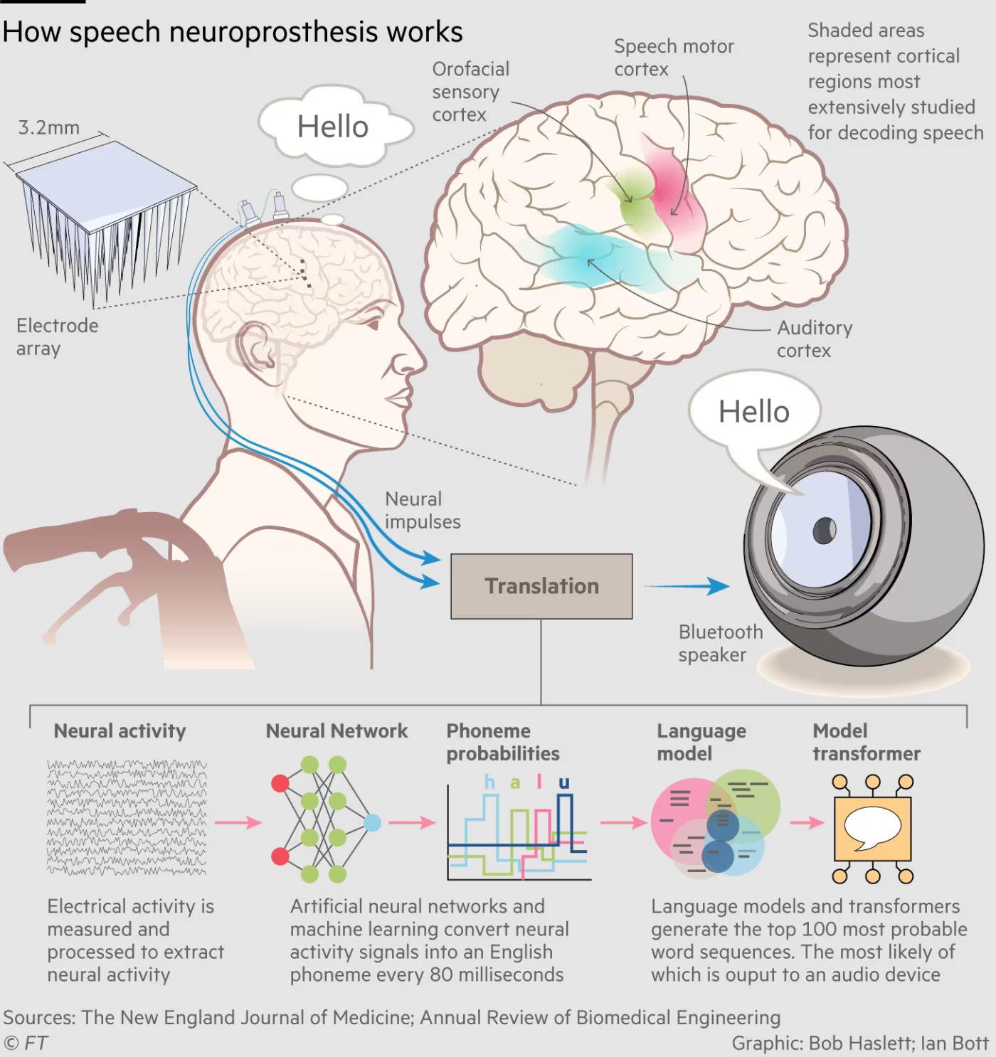  Fonctionnement d’une neuroprothèse vocale : des électrodes implantées mesurent l’activité cérébrale liée à la parole, traduite ensuite en sons via un réseau de neurones artificiels et un modèle de langage, jusqu’à sa restitution vocale en temps réel. © Bob Haslett ; Ian Bott