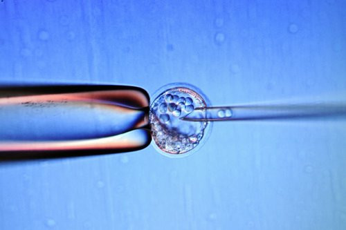 01F4000006165438-photo-la-recherche-sur-l-embryon-et-les-cellules-souches-autoris-e.jpg