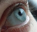 Google brevette l'implant d'une lentille connectée intraoculaire