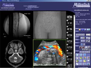 logiciel dicom gratuit