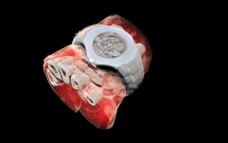 3D color scan of the human wrist MARS Bioimaging Ltd CERN Medipix3