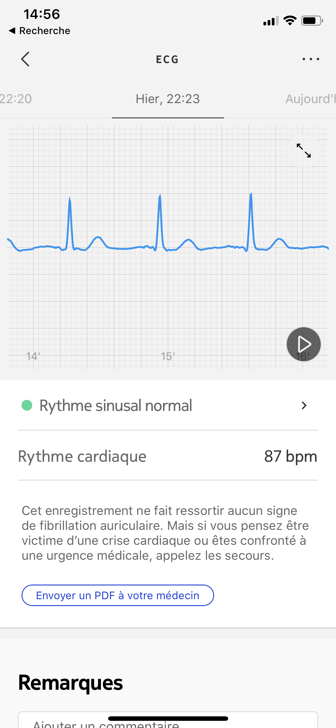 Test Withings BPM Core