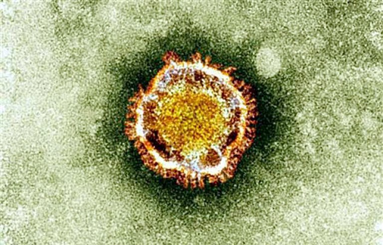 Photo fournie par l'Agence britannique de protection de la santé montrant le coronavirus à travers un microscope_cropped_0x0_cropped_0x0