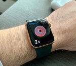 La nouvelle Apple Watch monitorerait la glycémie grâce à un nouveau capteur