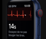 L'Apple Watch Series 7 et la Samsung Galaxy Watch 4 pourraient contrôler la glycémie