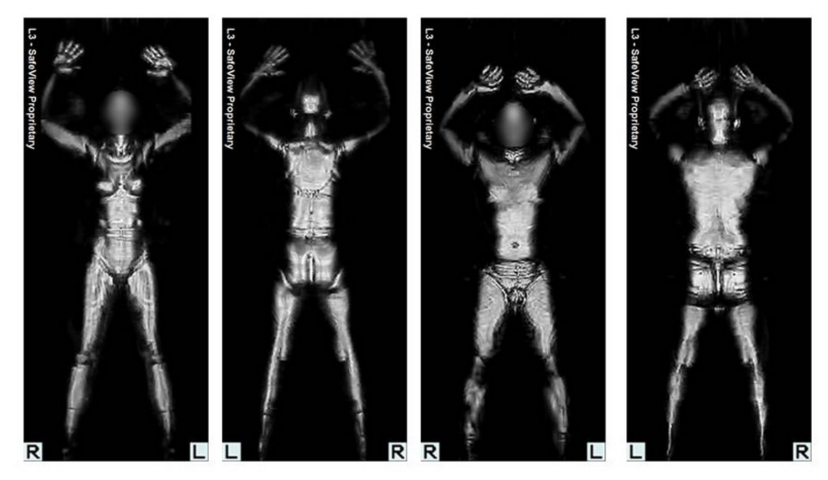 scanner à ondes millimétriques