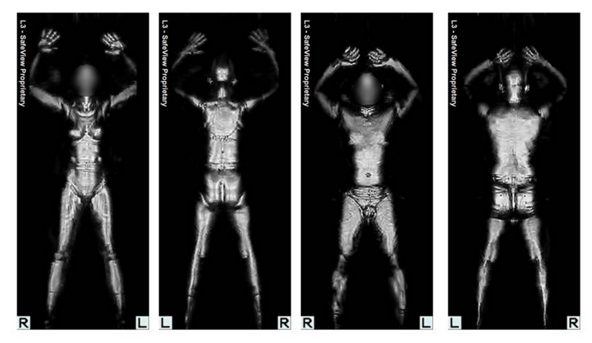 Image provenant d&#039;un scanner corporel à ondes millimétriques