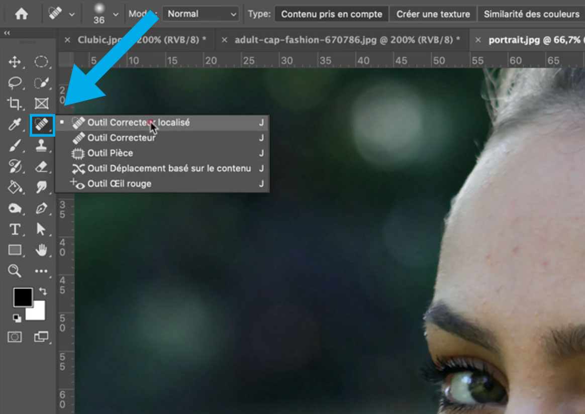 Localized Corrector © Romain Duclos