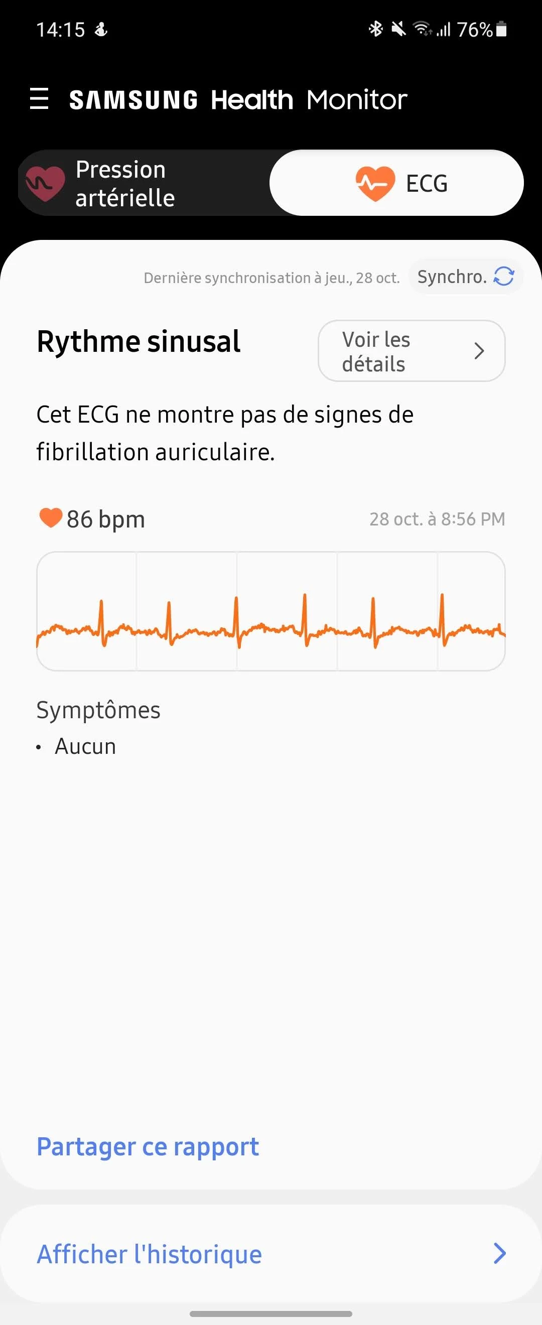 Samsung Health - ECG © Johan Gautreau