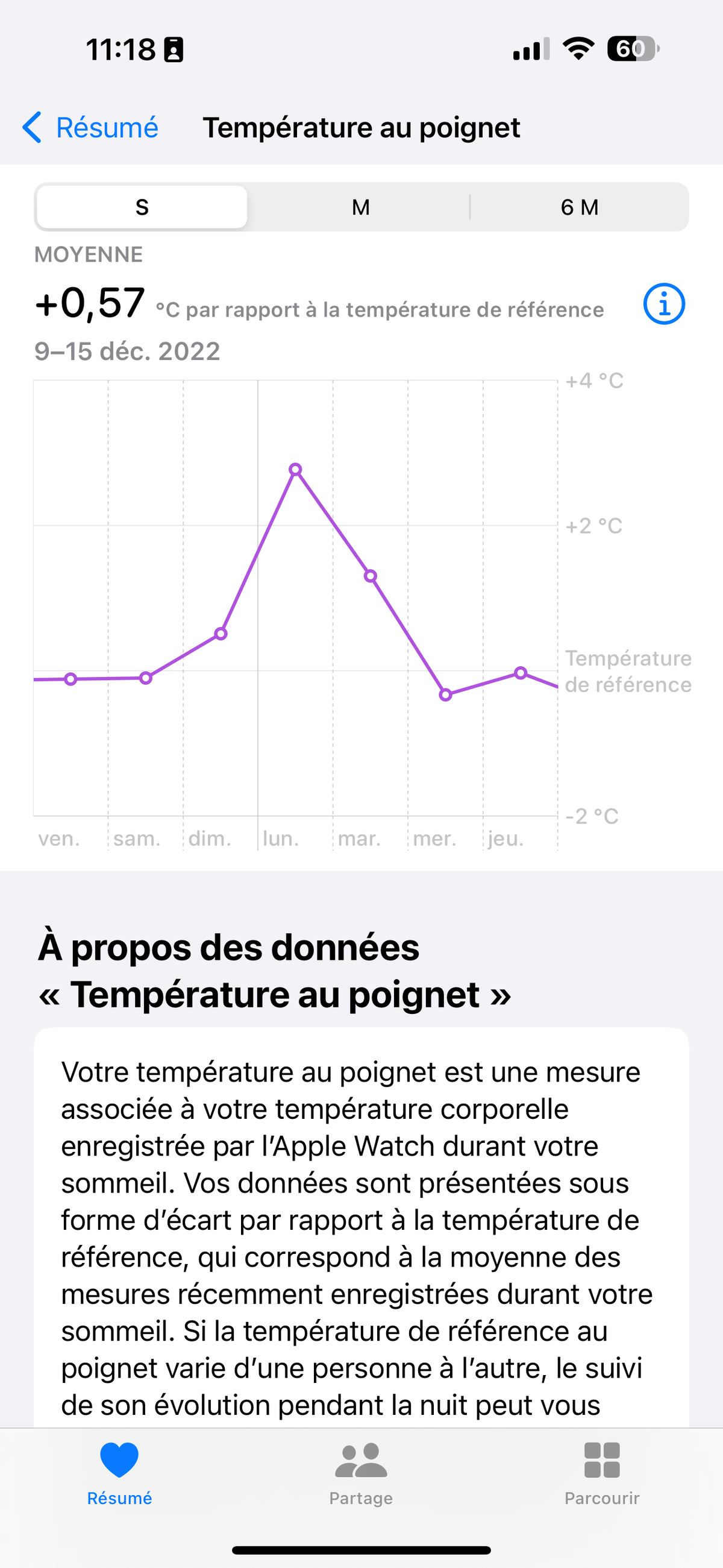 Test Apple Watch Series 8 © © Mathieu Grumiaux pour Clubic